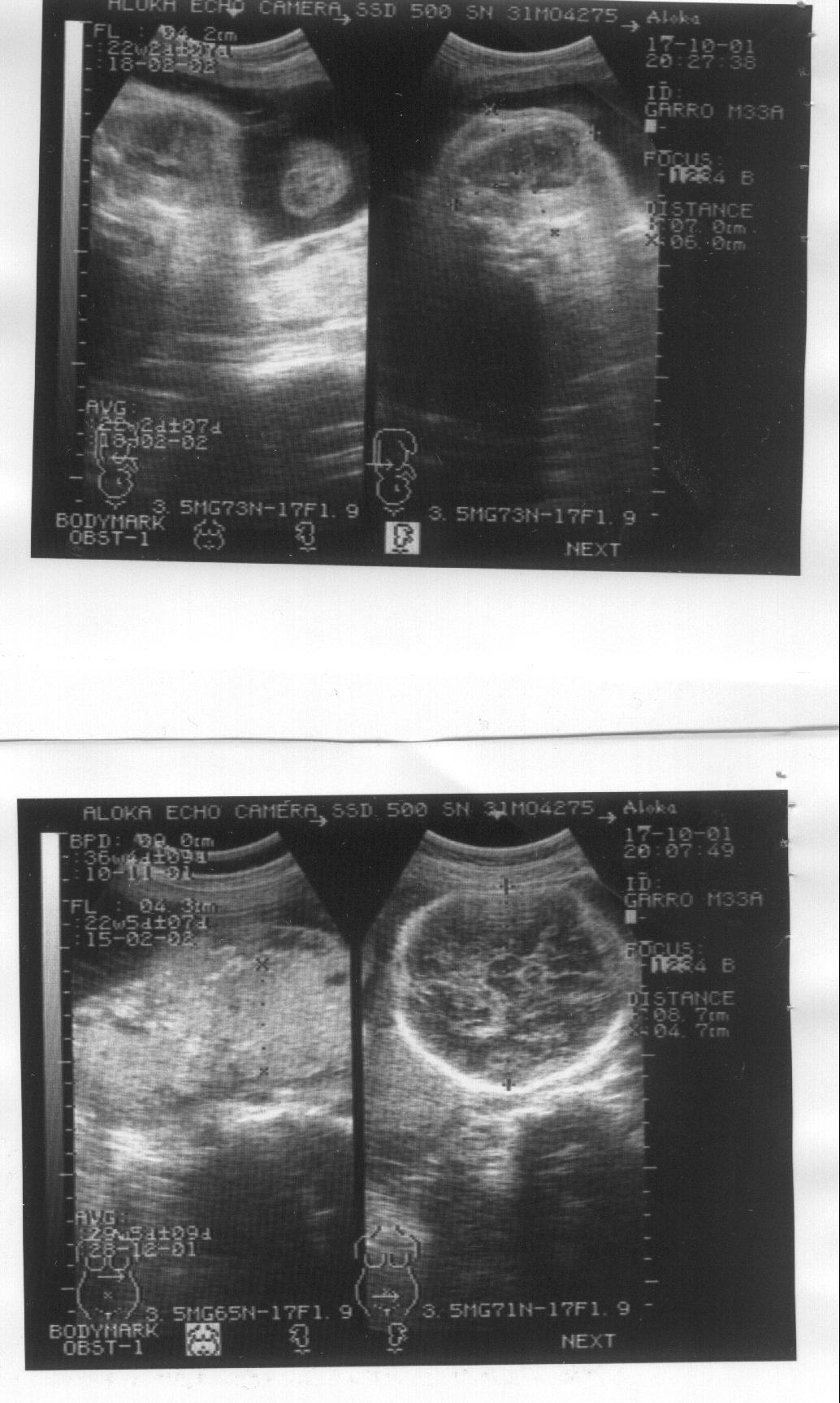 Imagen de la ecograf�a