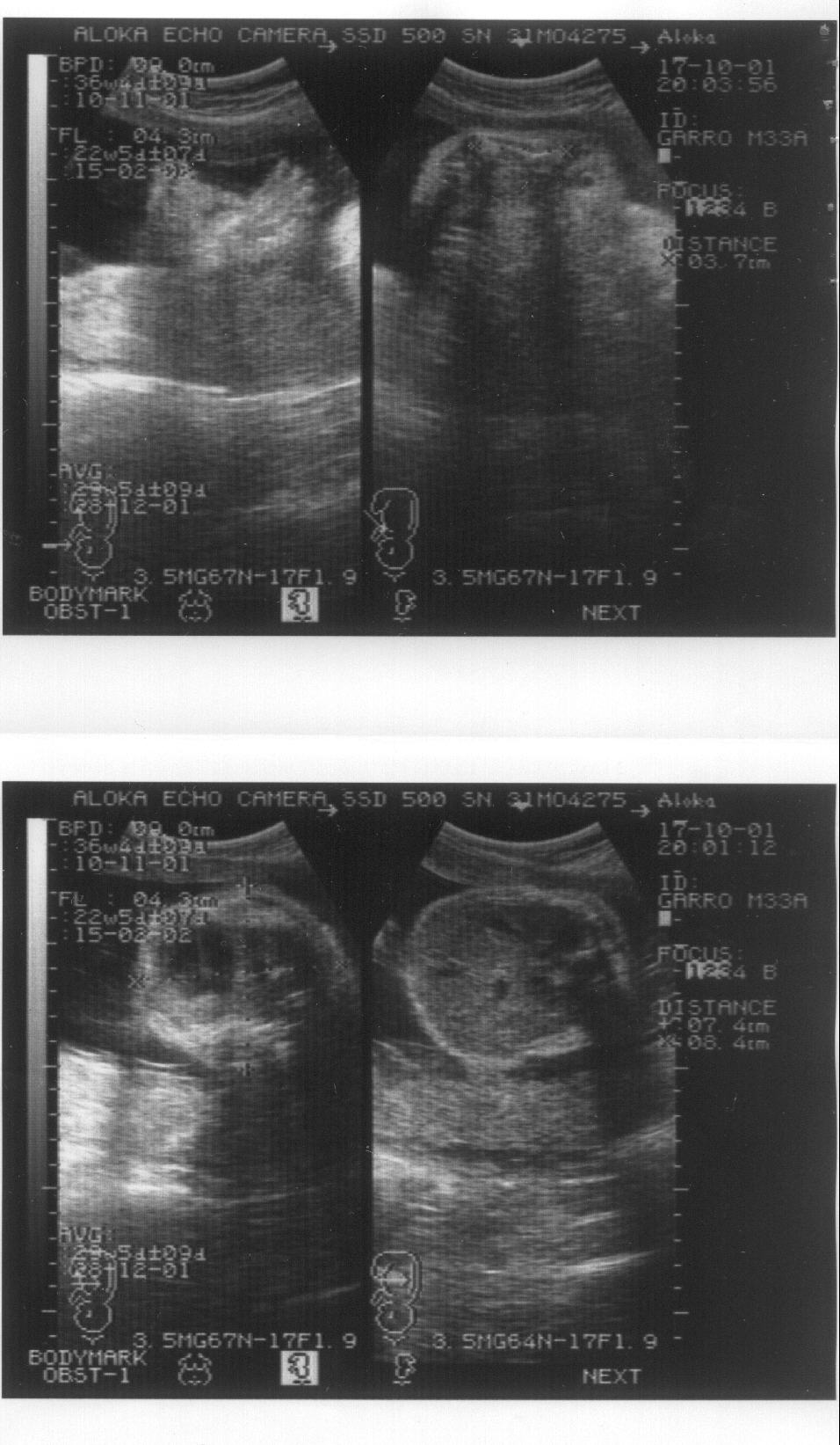 Imagen de la ecograf�a