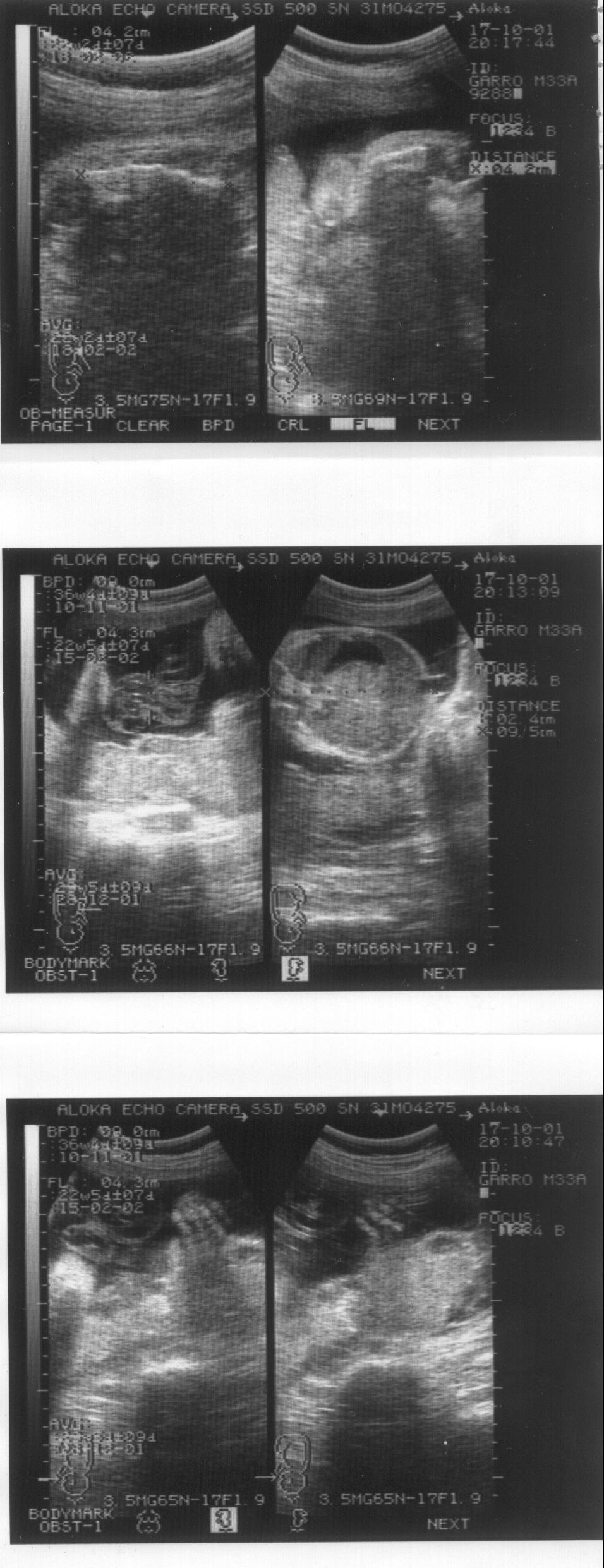 Imagen de la ecograf�a