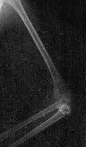 Imagen de la radiograf�a