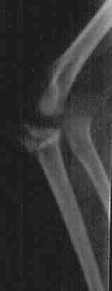 Imagen de la radiograf�a