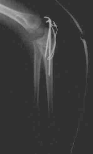 Imagen de la radiograf�a