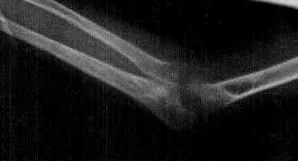 Imagen de la radiograf�a