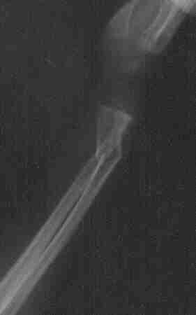 Imagen de la radiograf�a