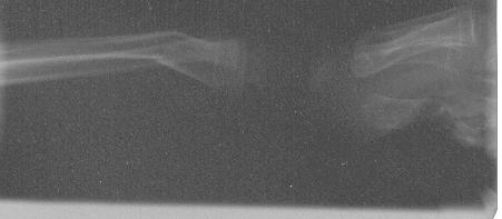 Imagen de la radiograf�a