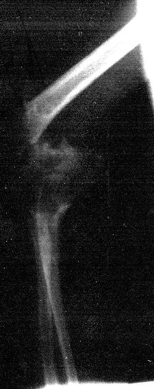 Imagen de la radiograf�a