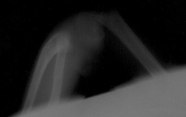 Imagen de la radiograf�a