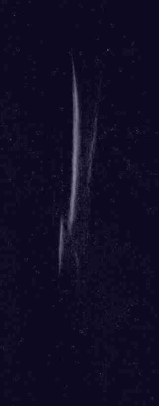 Imagen de la radiograf�a